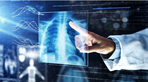 X-ray imaging technology